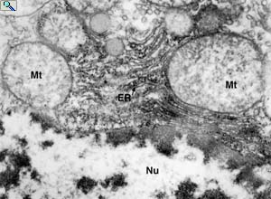 EM of liver