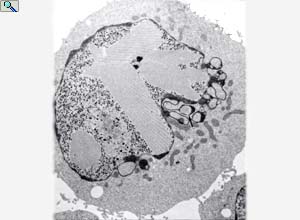Late Ad5 infection