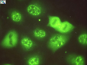 RNA splicing factors liver