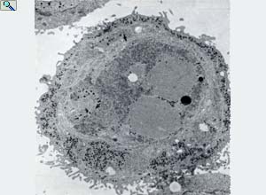 late Ad5 infection