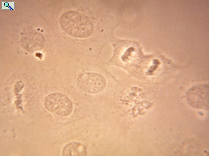 phase contrast liver cells